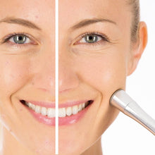 BEURER FC 100 Pureo Derma Peel mikrodermoabrazija za lice