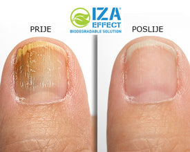 IZAEFFECT sprej protiv gljivica na noktima i stopalima, 2 x 100 ml - Vitashop