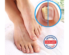 IZAEFFECT gel za terapiju stopala, XXL 100 ml